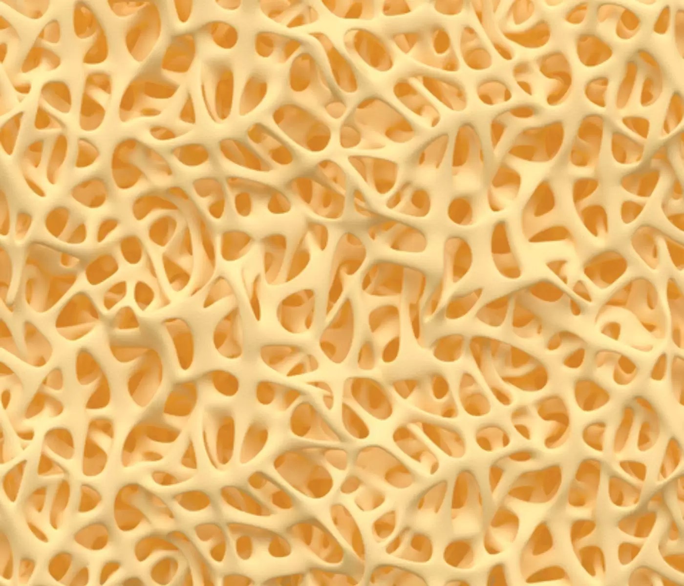 Possible causes of keel bone fractures (KBF) on laying hens