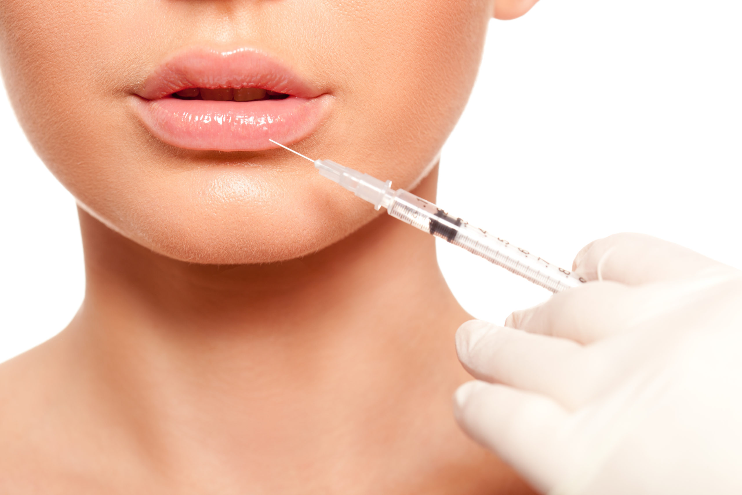 How Do Dermal Fillers Work? Aviva Med Spa