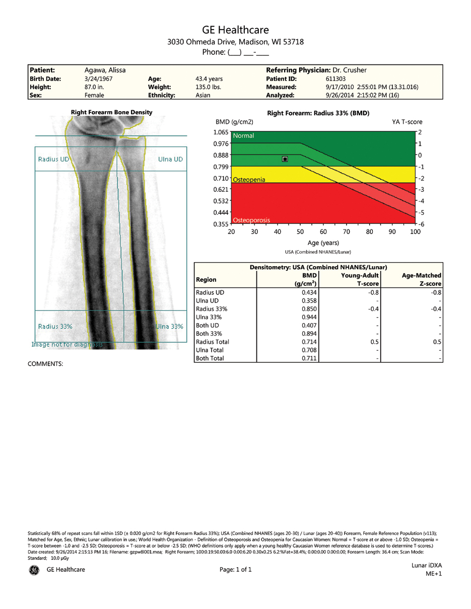 GE Healthcare bone density report sample