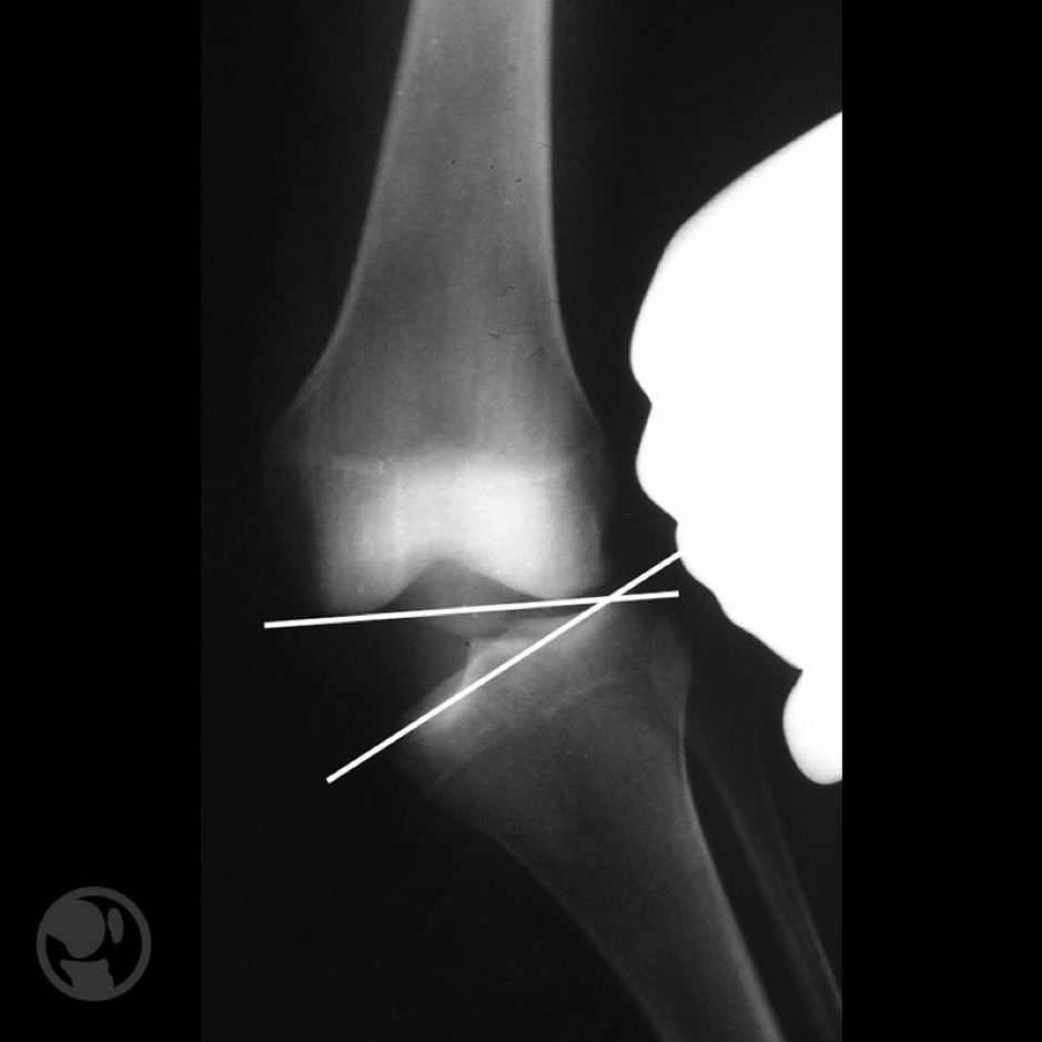 Guía fácil para iniciarte en las estructuras ligamentosas mediales de
