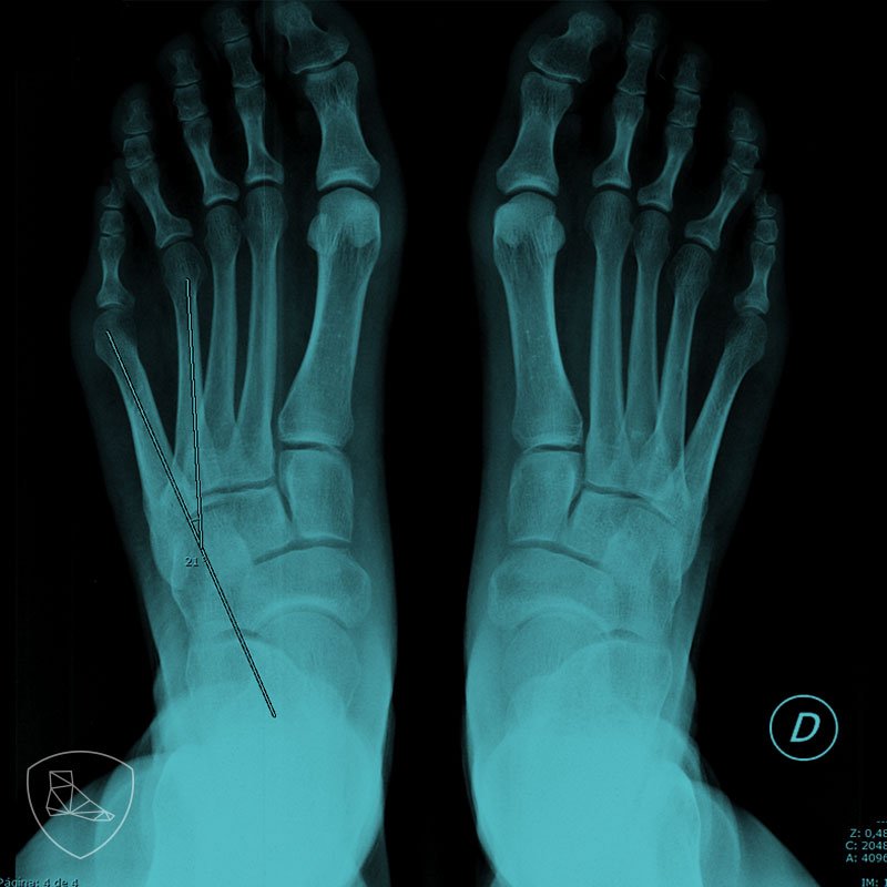 Guia básica del Quintus Varus aware.doctor