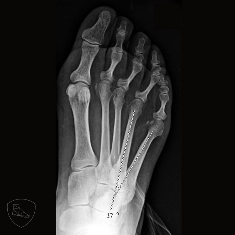 Guia básica del Quintus Varus aware.doctor