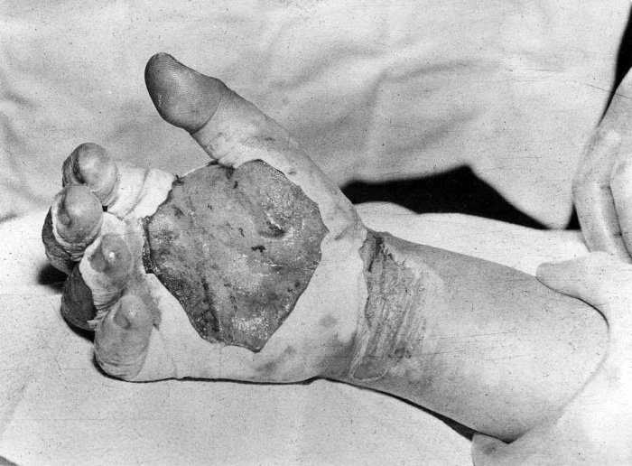 Plutonium ‘Demon Core’ Has Killed 2 Physicists Without