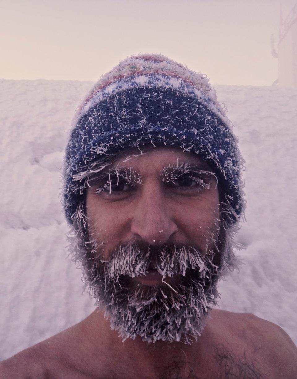 8 Photo's Of People With Crazy Frozen Hair •