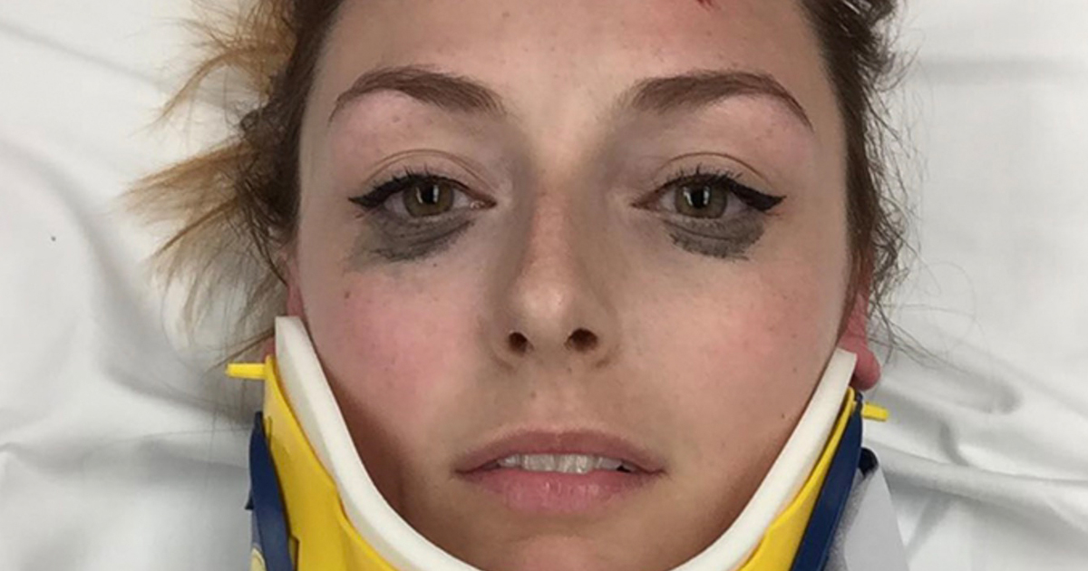 Woman Praises Her Eyeliner After It Survives Nasty Car Crash