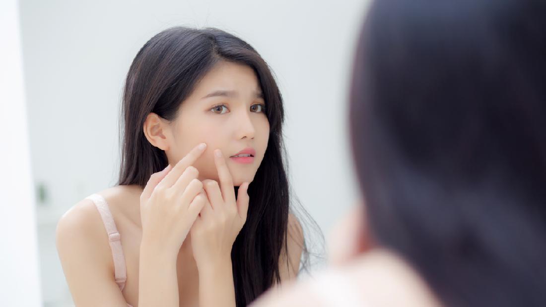 Tak Ingin Wajah Breakout saat Lebaran? Ini Saran Dokter Kulit