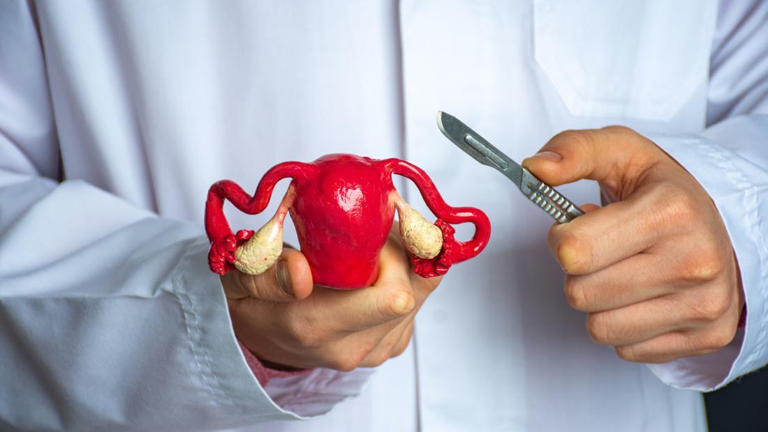 Waspada! Menstruasi Tak Normal Bisa Berpotensi Miom & Kista Ovarium