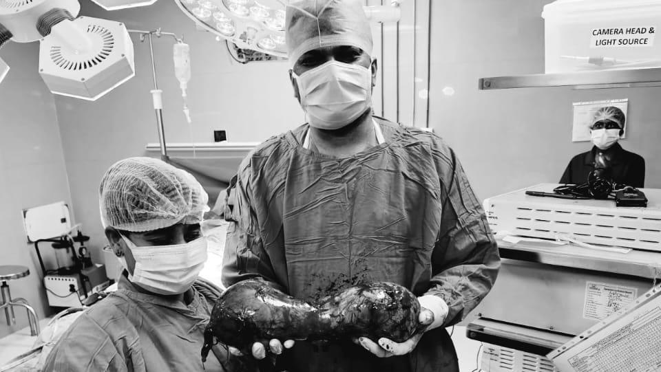 Awal Mula Pria 30-an Idap Tumor Testis Raksasa 40 Cm, Begini Kondisinya