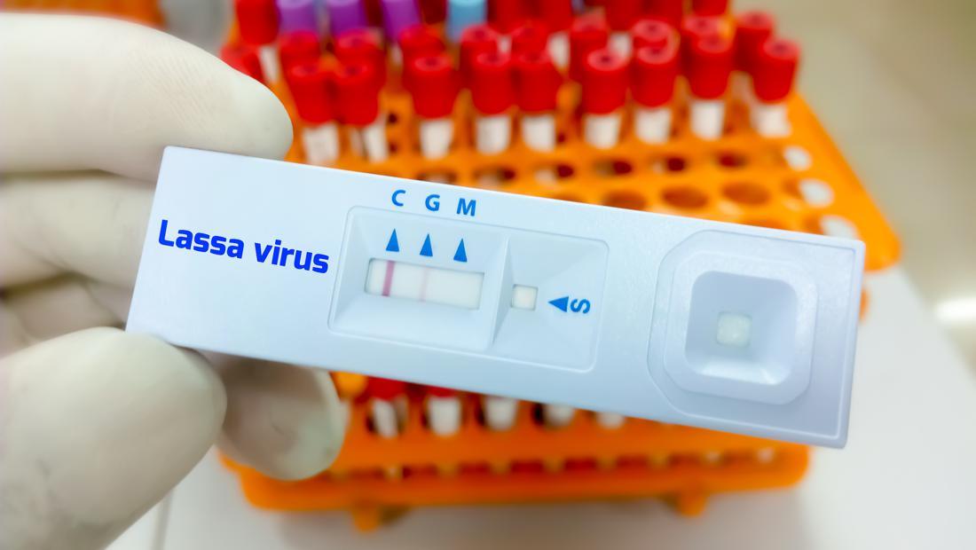 Kata Epidemiolog soal Demam Lassa yang Picu 163 Orang Meninggal di Nigeria