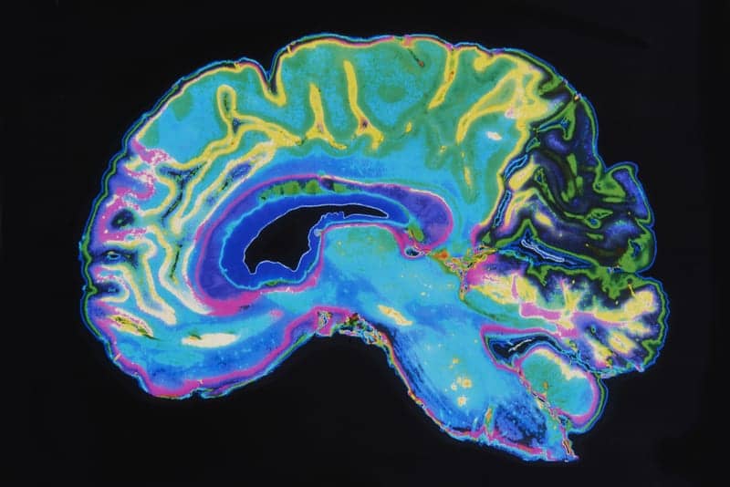 Slow, Steady Waves Detected in MRI Keep Brain Humming Axis Imaging News