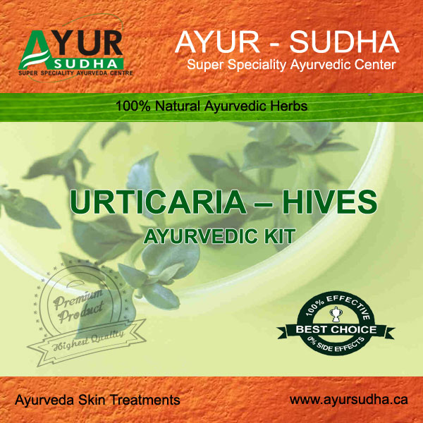 Urticaria Hives Ayurvedic Kit AyurSudha