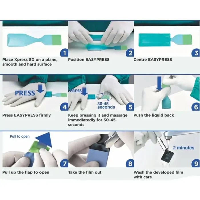 Xpress SD Self Developing XRay Films Ayushi Density