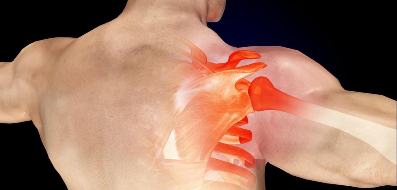 الم الكتف من الخلف , الحصول علي كتف سليم ازاي