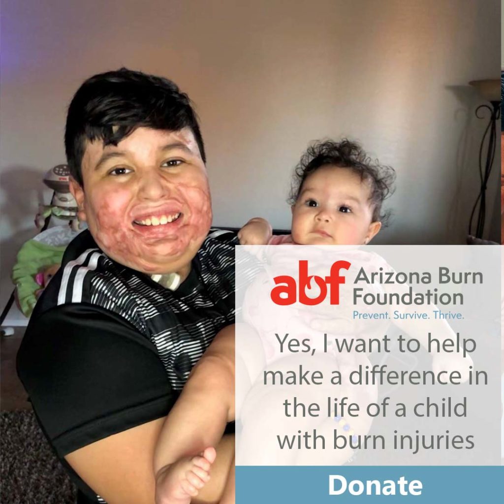 Home Arizona Burn Foundation