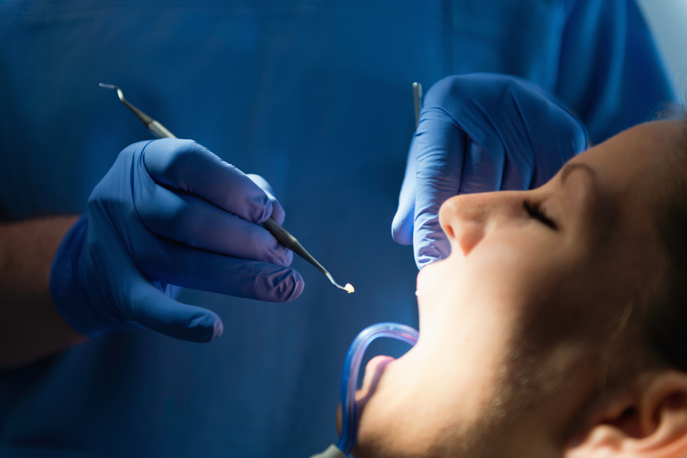 Why Should You Choose Tooth Colored Fillings? Advanced Laser