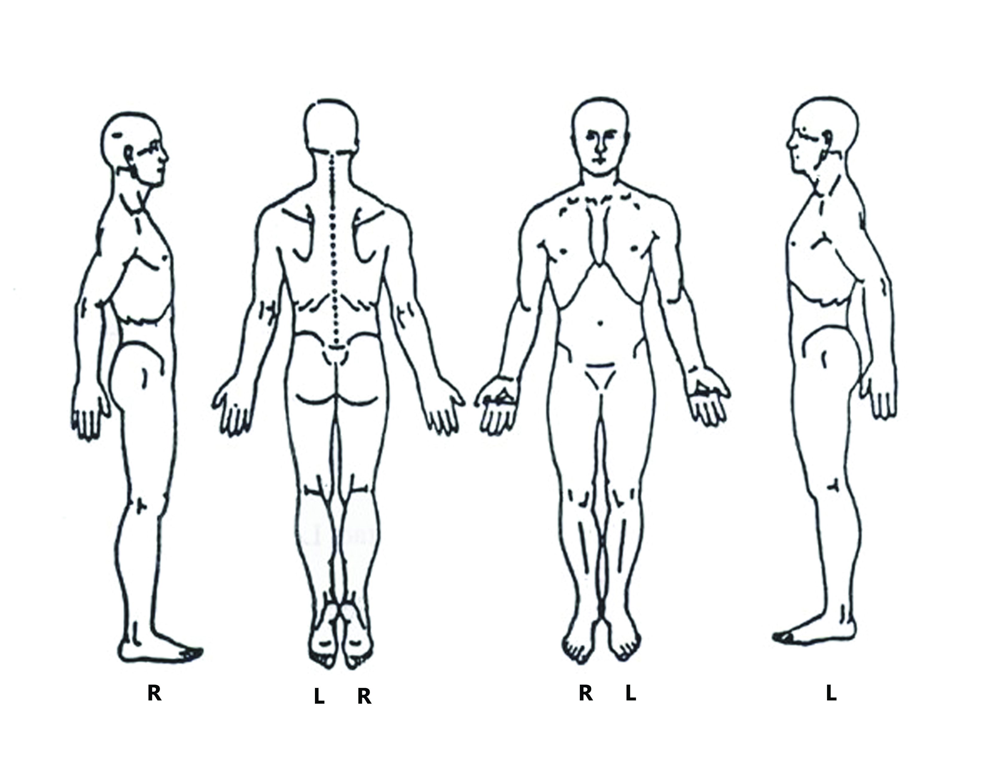 Forms