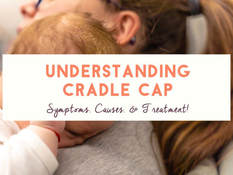 Understanding Cradle Cap Symptoms, Causes, and Treatment