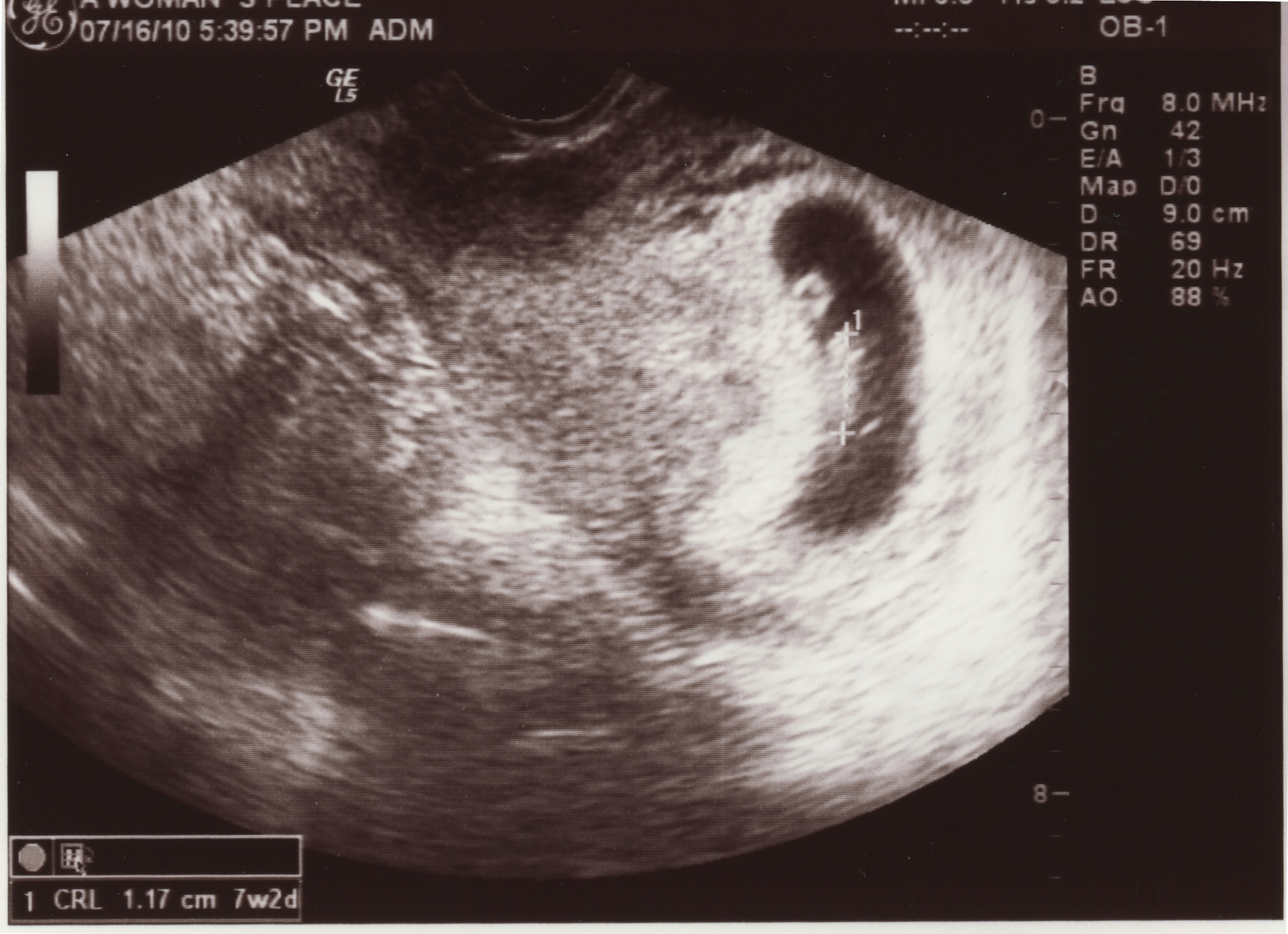 Baby Blog » So, about this pregnancy thing…