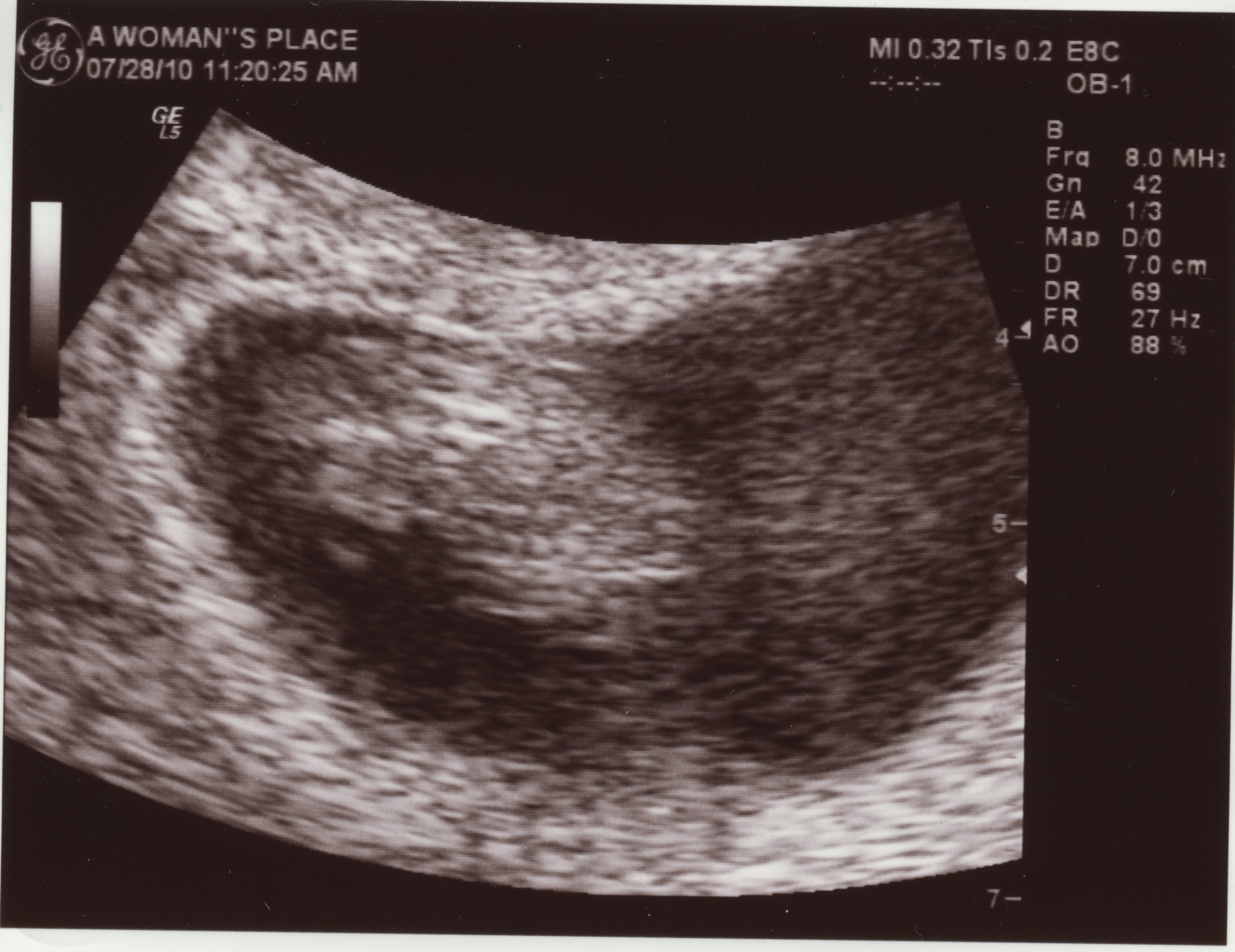 Baby Blog » So, about this pregnancy thing…