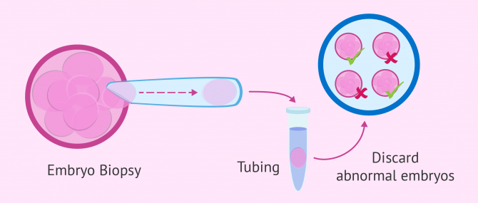 Egg and Sperm Donation in Assisted Reproduction