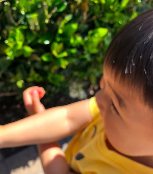 Sunlight, Vitamin D, and Eczema Baby Rash Care