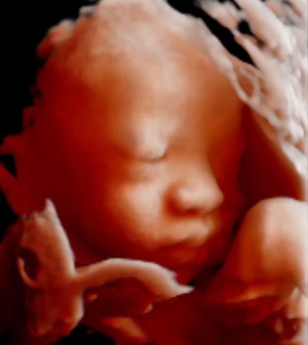 3d ultrasound toronto price