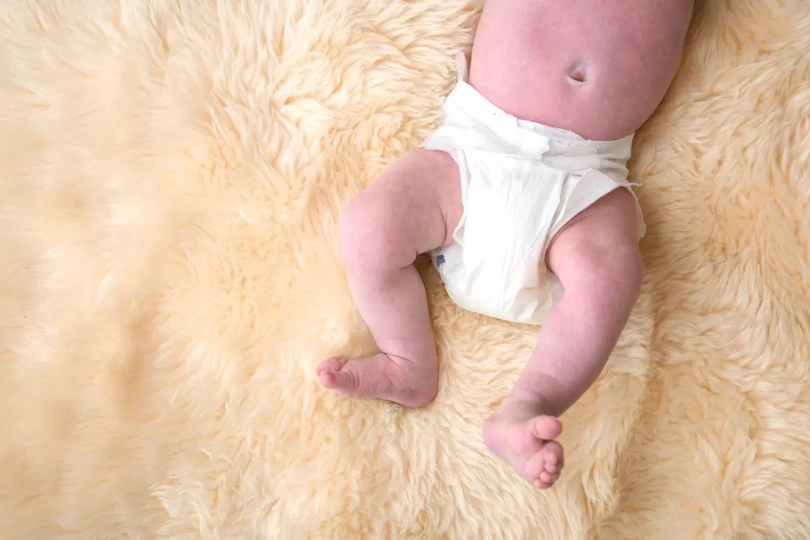 What Is Nappy Rash? Causes & Symptoms BabyYumYum