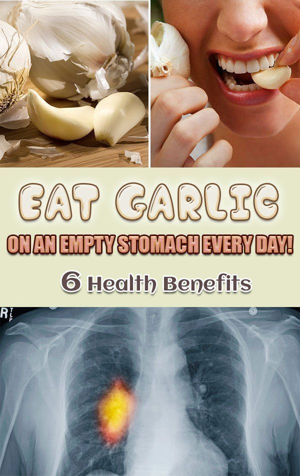 The Healing Power Of Garlic How This Pungent Herb Can Help Heal Your