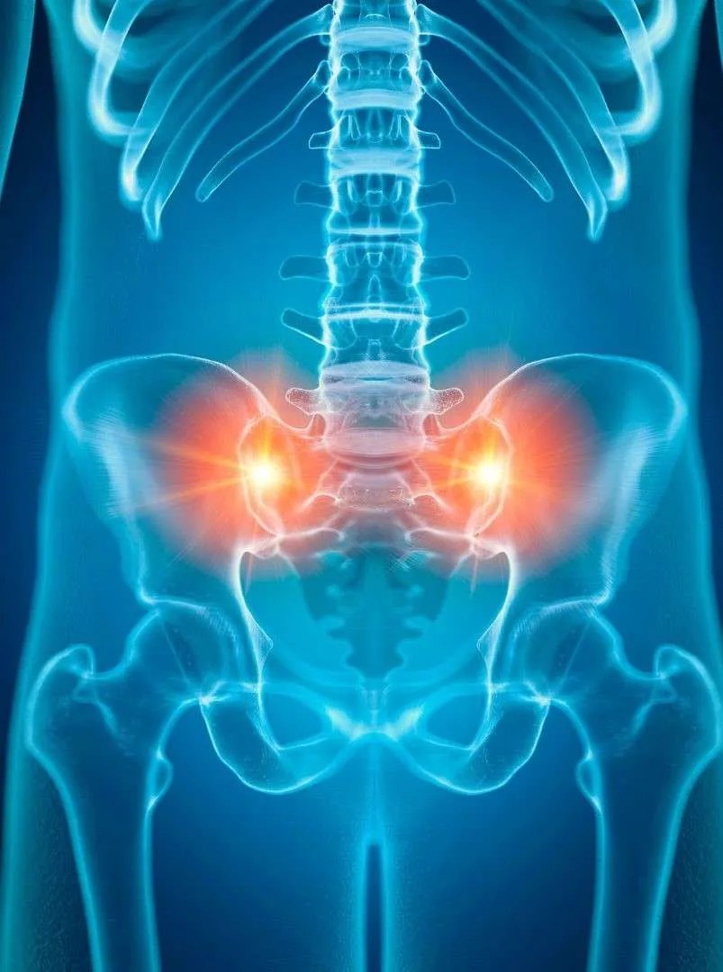 All About Sacroiliac Joint Dysfunction
