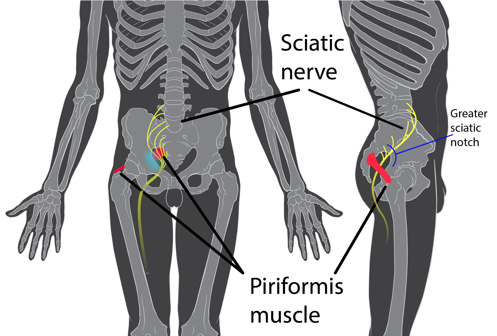 Piriformis Syndrome, Will An Inversion Table Help Read Here