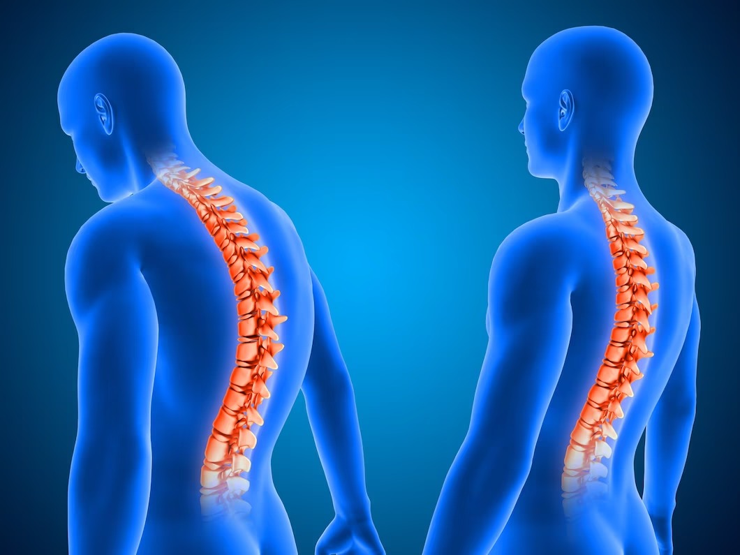 Spine Injury Best Physiotherapy Clinic in Dhaka Back In Motion