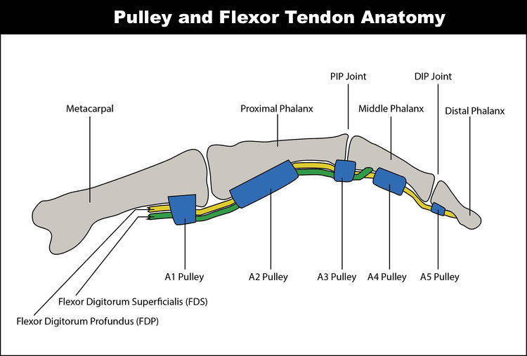 Flexion pulley injury Back to Active Sports and Spinal Macquarie Park