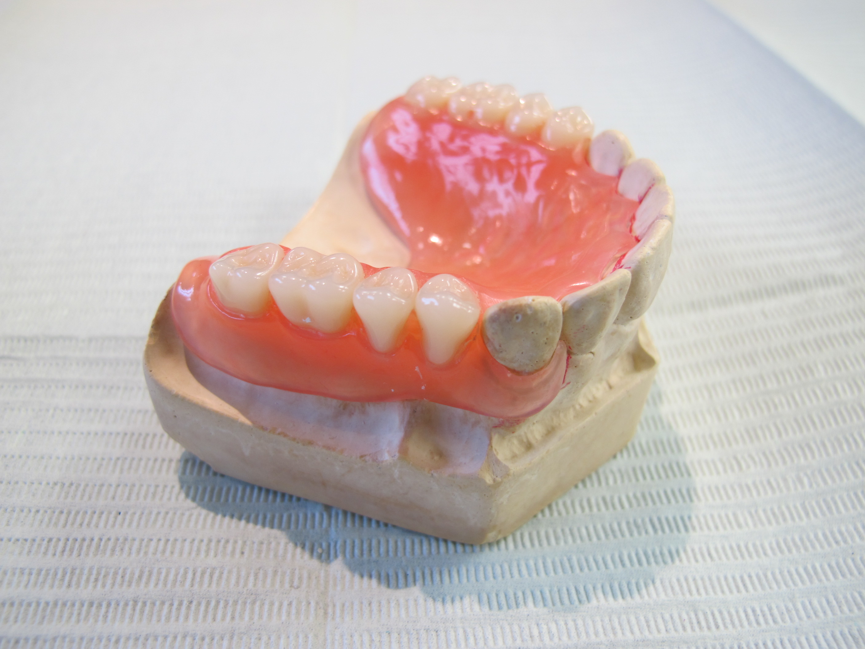 Flexible / Resilient Based Partials Baker Lanoue Denture Clinic