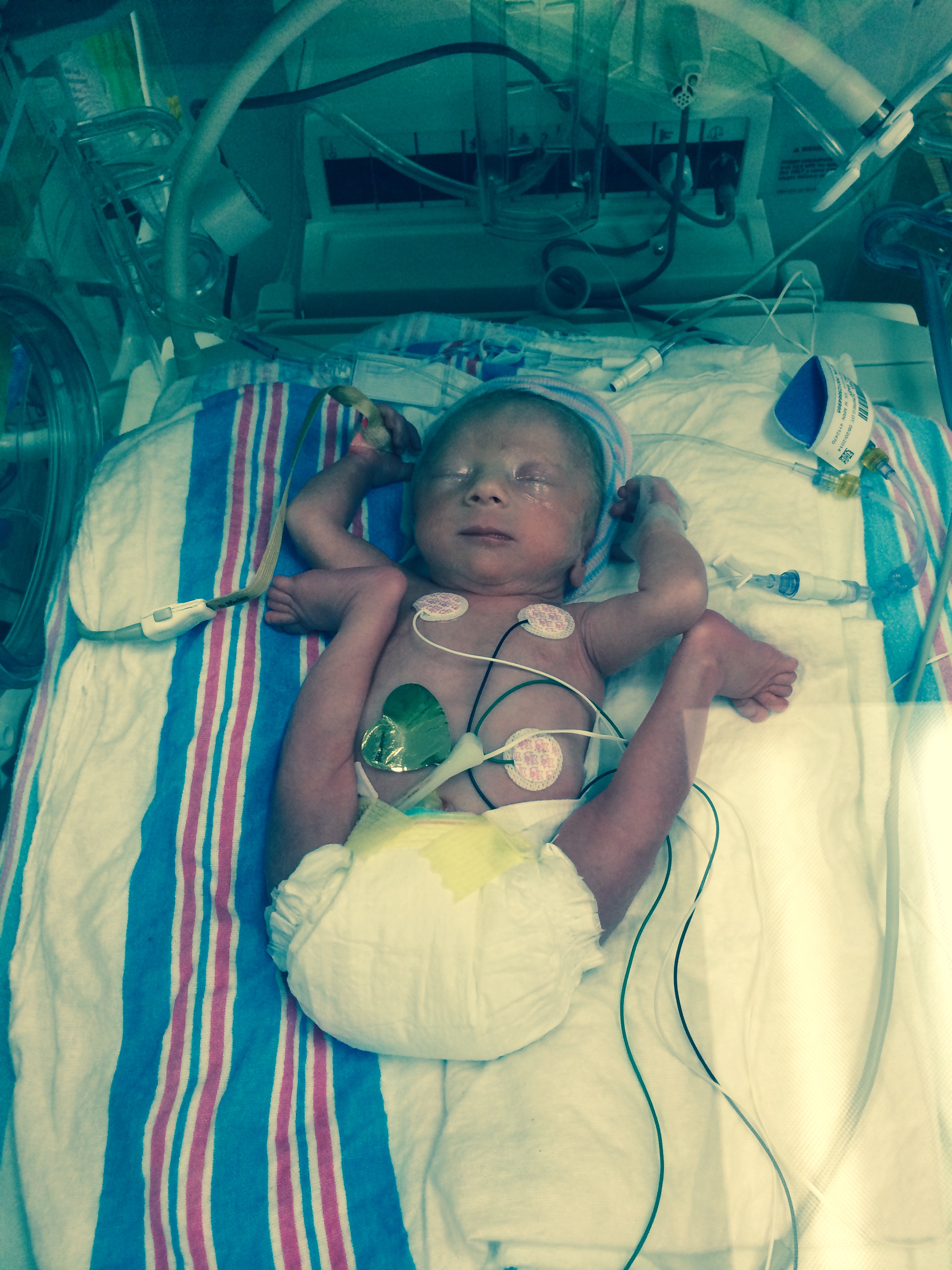 Spinning Babies Frank Breech at Paulene Meyer blog