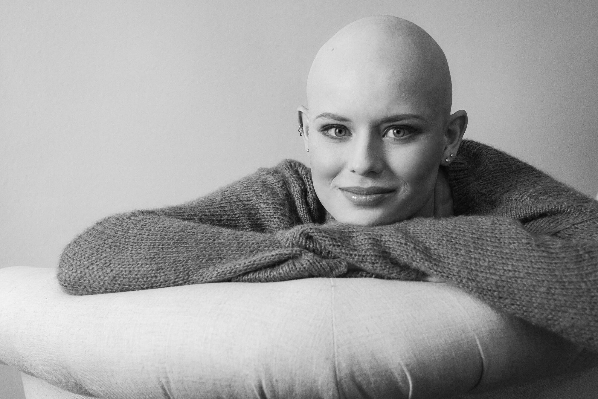 pro photos Bald Socks