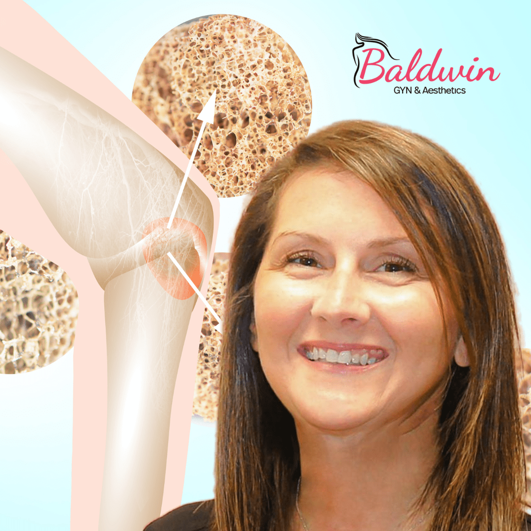 Osteoporosis What Preventative Measures Should You Take?