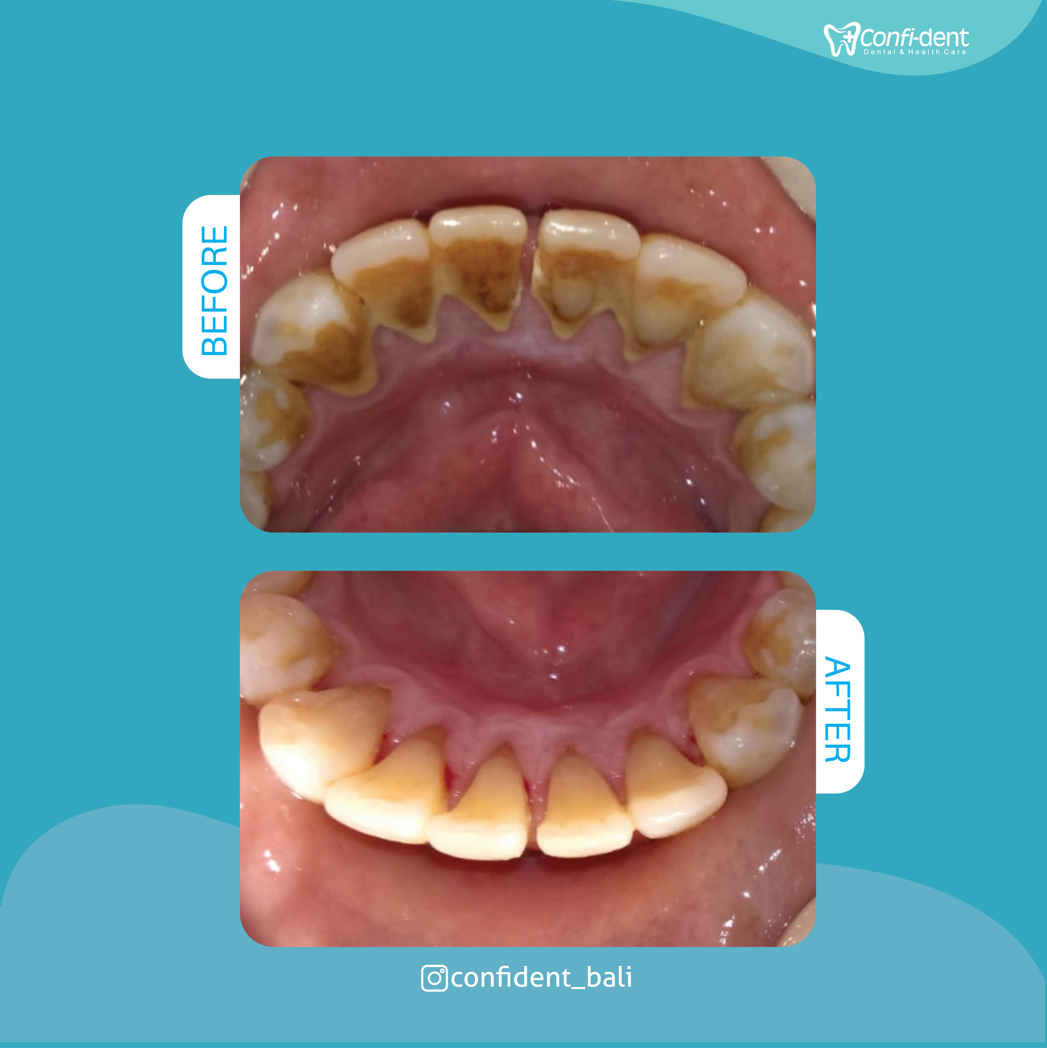 Confident Bali Dental Clinic Best Dentist in Bali