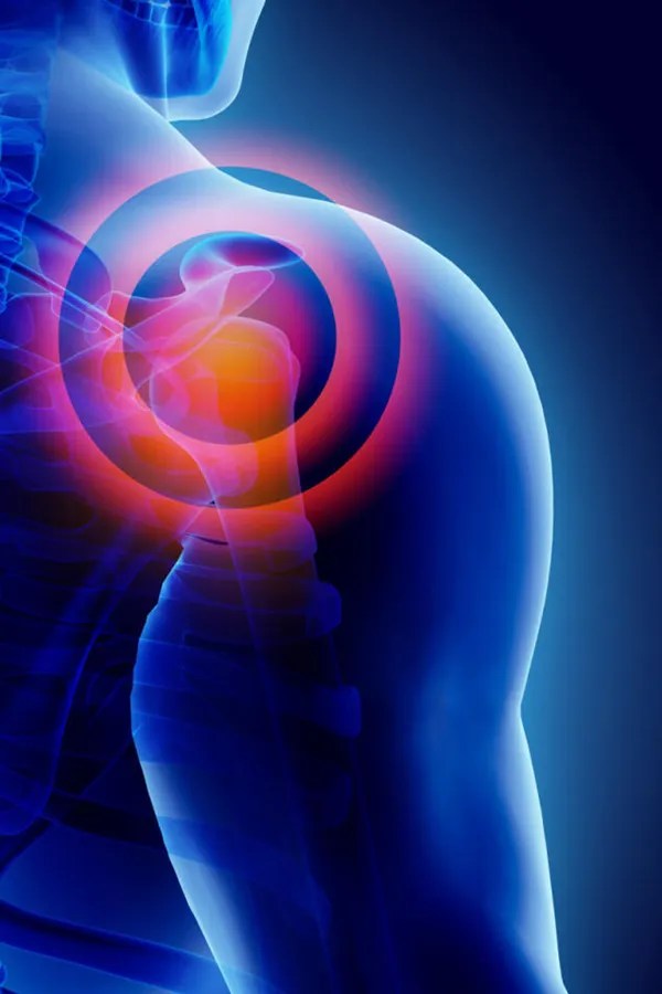 Baltimore PRP Injections for Shoulder Injuries