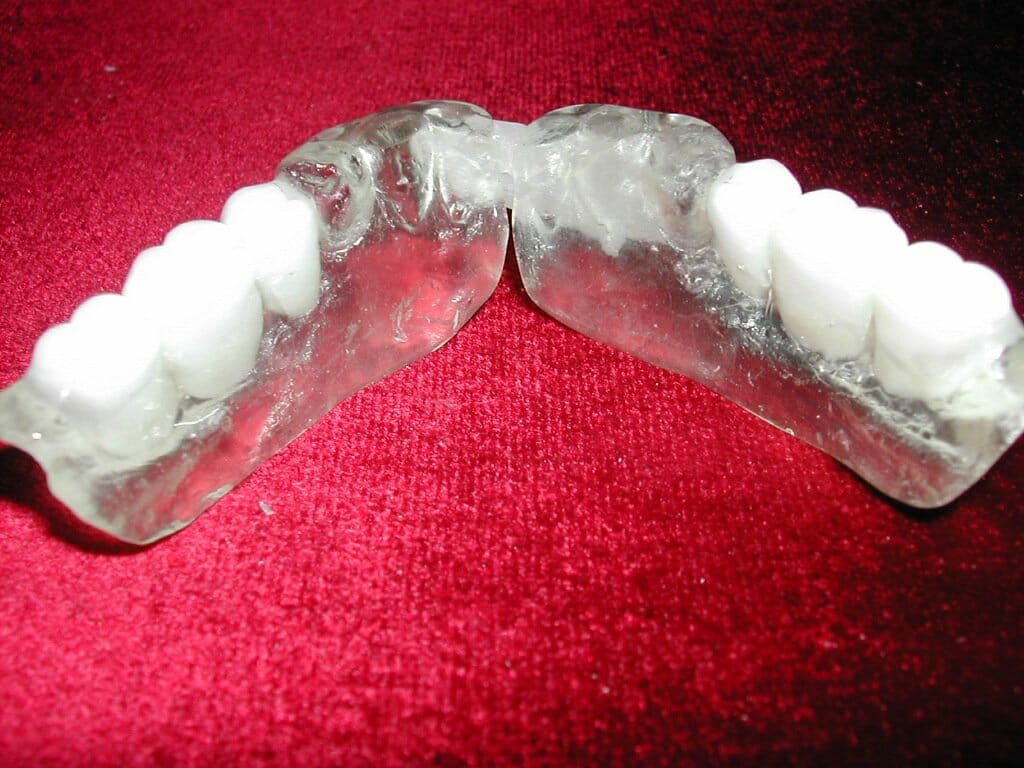 Digital Dental Implant Surgical Guides Baluke Dental