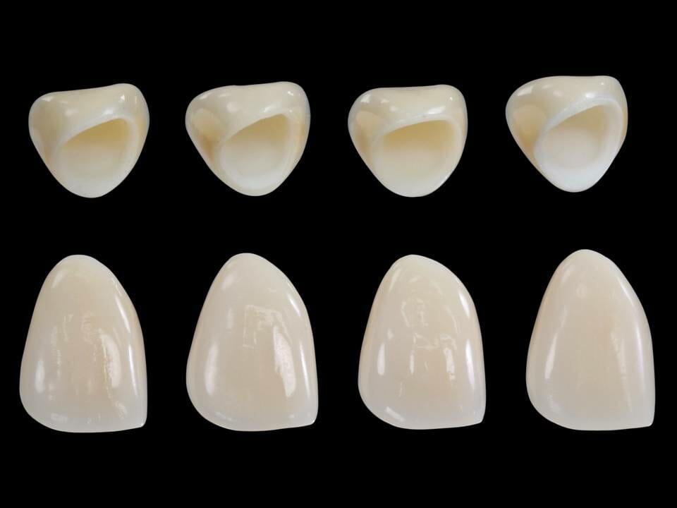 Zirconia Coping Baluke Dental Studios