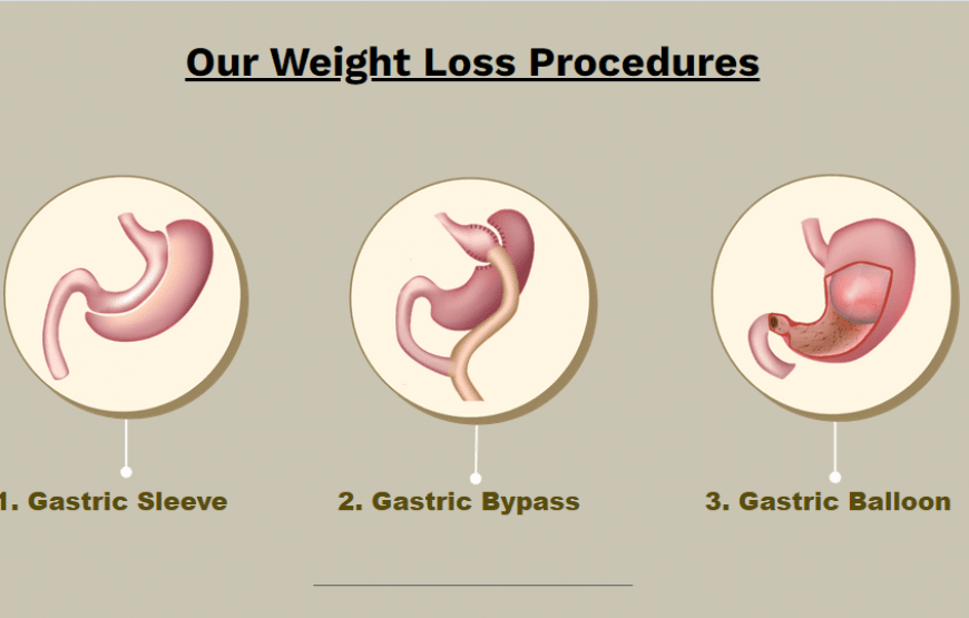 Gastric Sleeve Thailand – Bangkok Local Guide