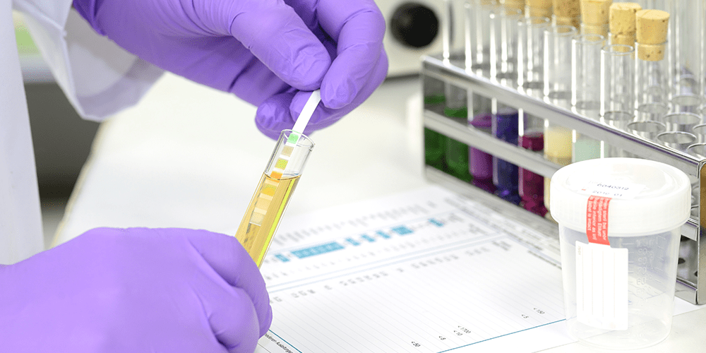 What Are the Benefits of PreEmployment Drug Screening Tests?