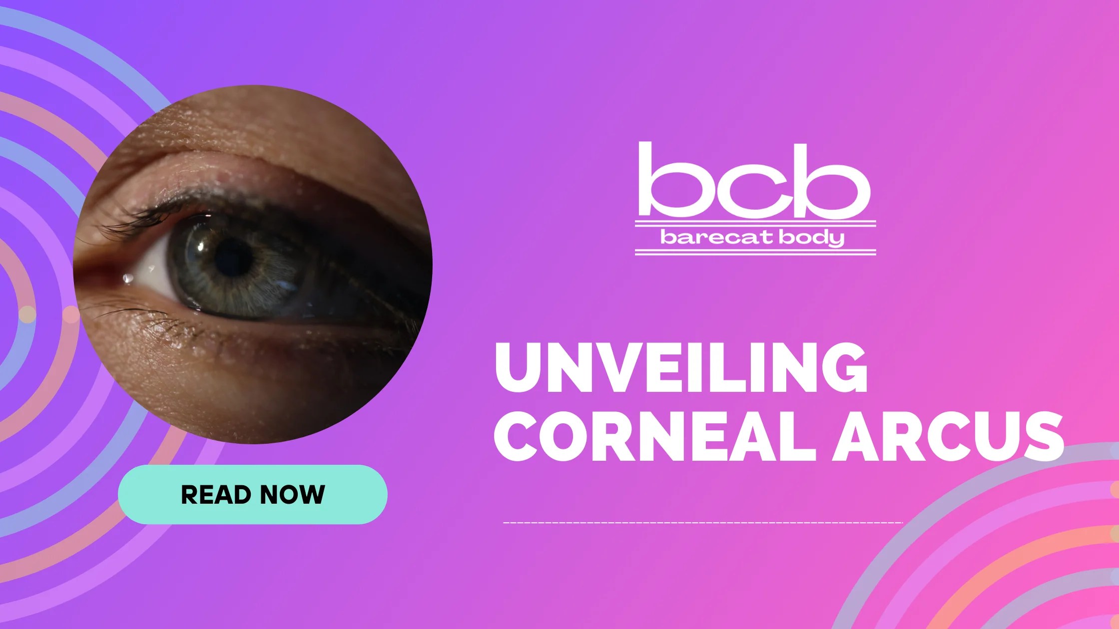 Unveiling Corneal Arcus Understanding Its Causes, Health Implications