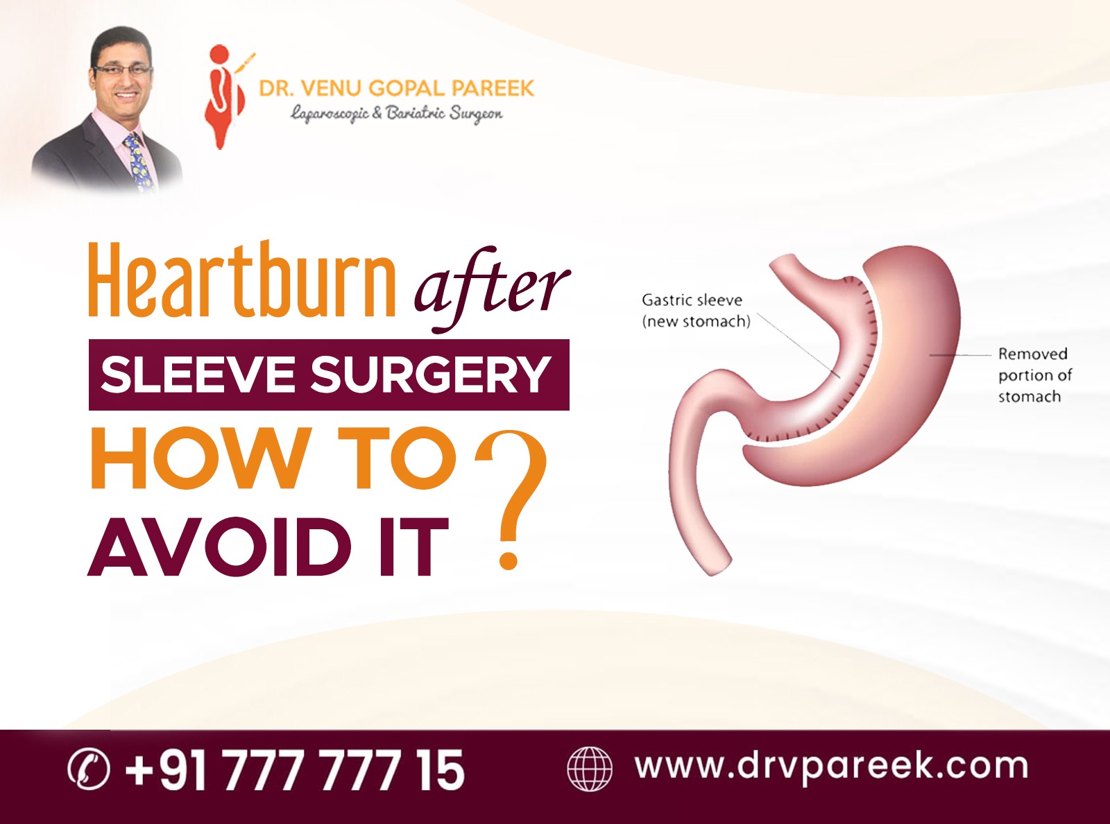 Heartburn after sleeve surgery how to avoid it ? Bariatric Surgeon India