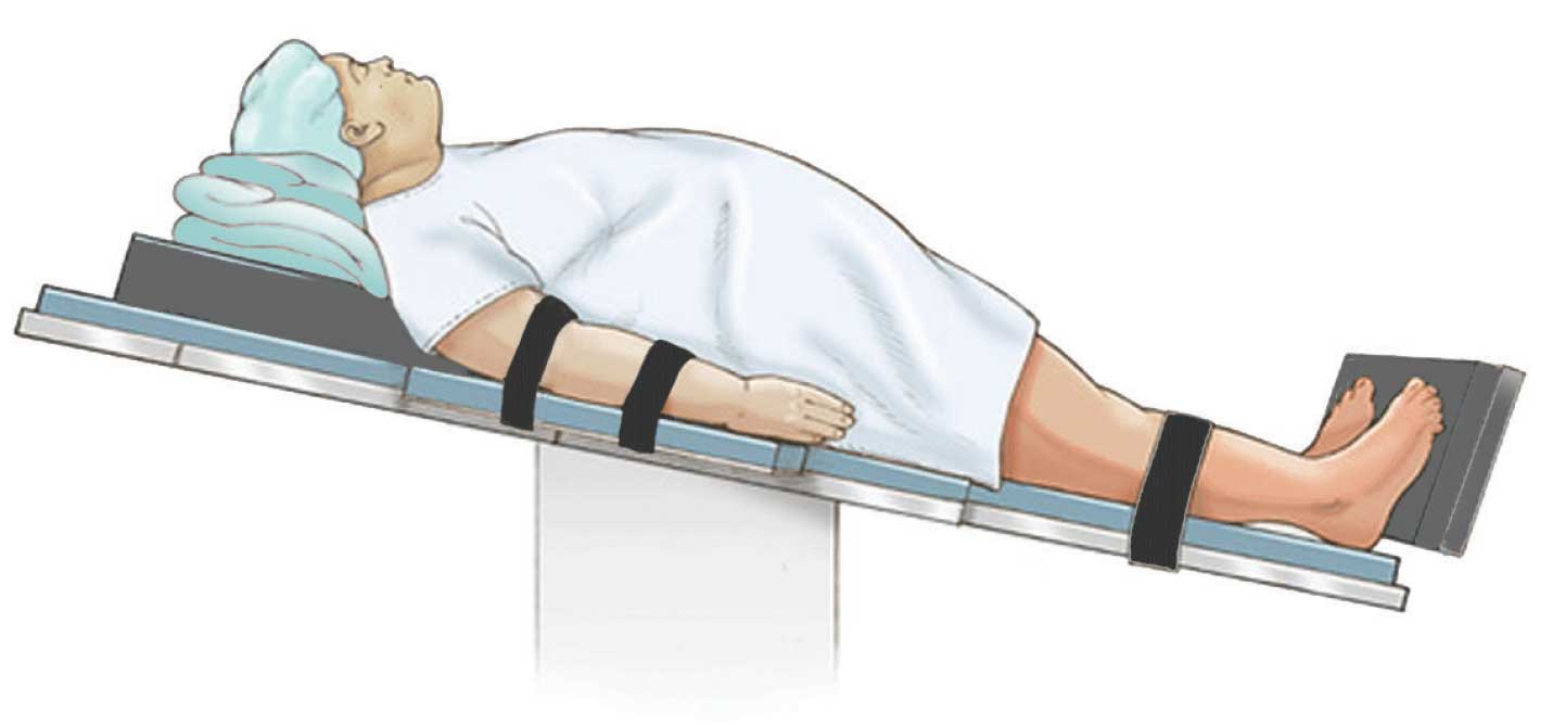 Patients with Obesity Need Not Routinely Undergo Rapid