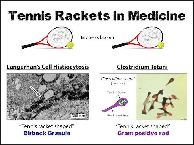 Tennis Racket Pathology