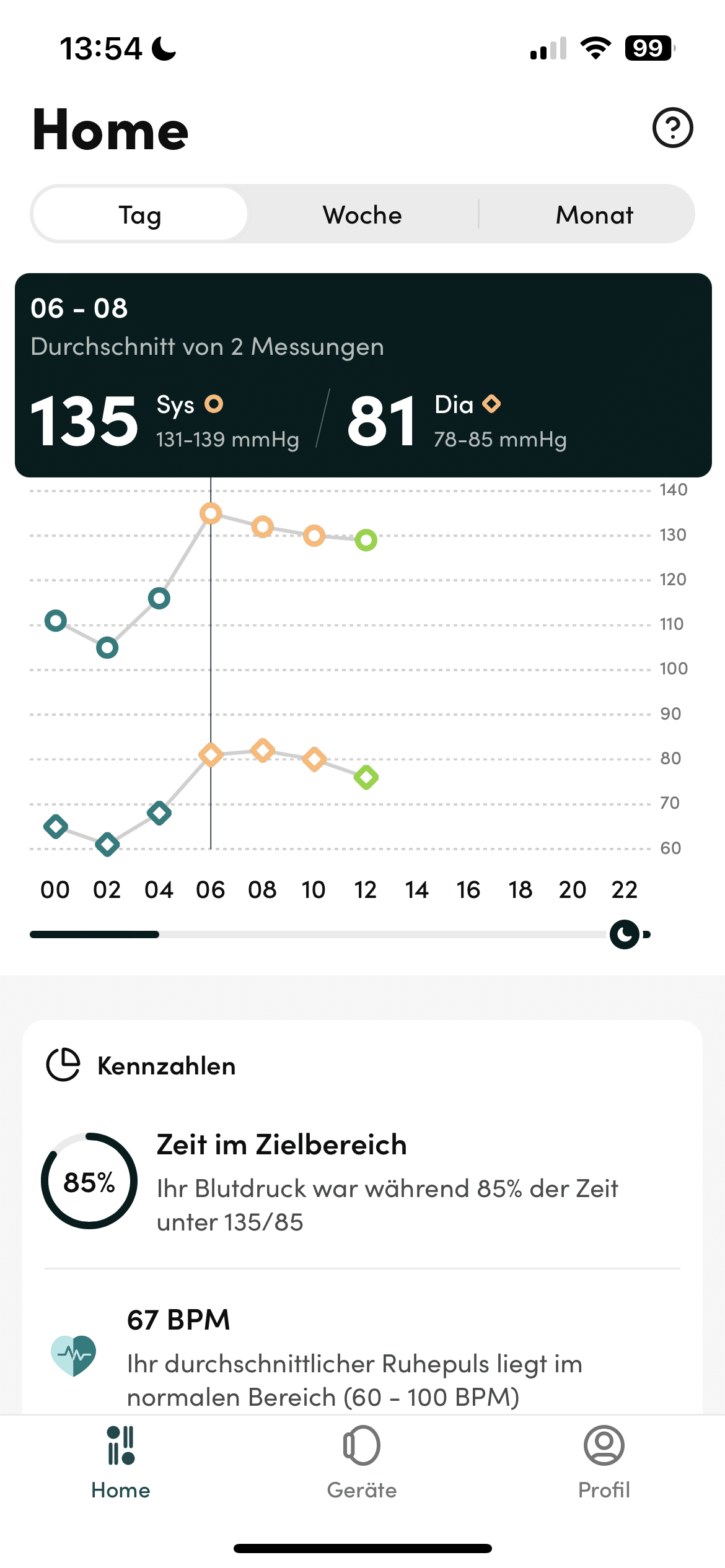 Aktiia in test: Simple 24-hour monitoring of blood pressure