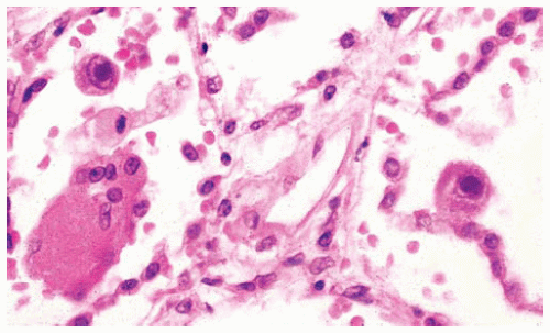 Viruses Basicmedical Key