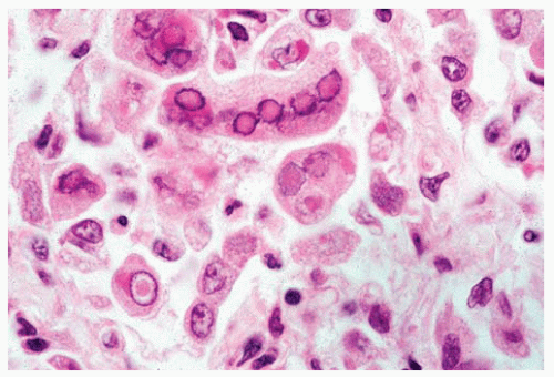 Viruses Basicmedical Key