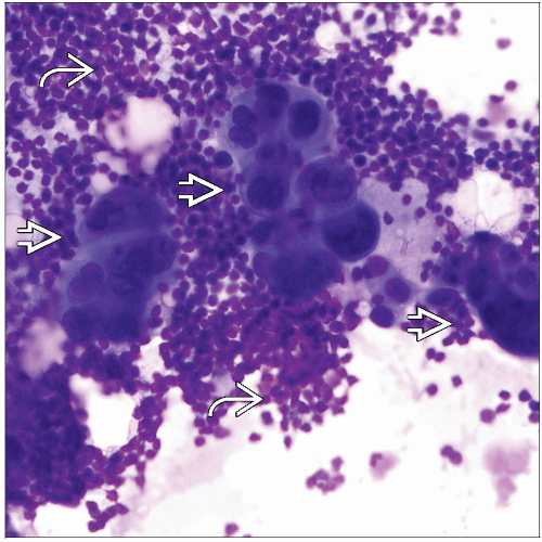 Cytologic Examination Basicmedical Key